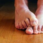 Bullofas en los pies: síntomas, tratamiento y prevención